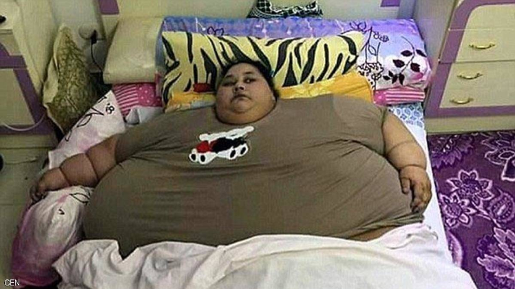 Photo of सर्जरी से पहले ही दुनिया की सबसे मोटी महिला का 120 किलो वजन घटा.