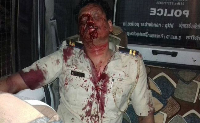 Photo of होटल मालिक ने ऑन डियूटी पुलिस कर्मी पर किया हमला , पुलिस कर्मी बुरी तरह हुआ जख्मी .