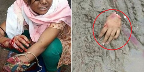 Photo of एक तरफा प्यार में नाकाम सिरफिरे ने काटा एक 13 साल की बच्ची का हाथ