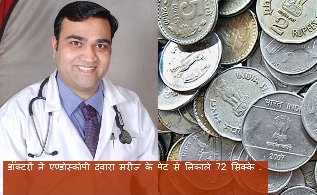 Photo of महाराष्ट्र : डॉक्टरों ने बिना ऑपरेशन के एण्डोस्कोपी द्वारा मरीज के पेट से निकाले 72 सिक्के .