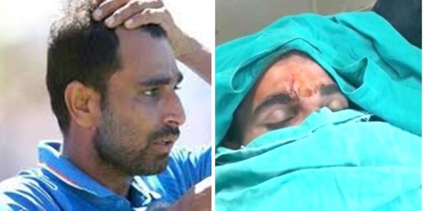 Photo of शमी के चोट पर बोले डॉक्टर , IPL की तैयारियों को लगा झटका